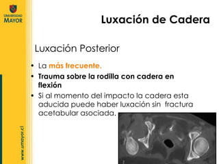 La  más frecuente. Trauma sobre la rodilla con cadera en flexión Si al momento del impacto la cadera esta aducida puede haber luxación sin  fractura acetabular asociada. Luxación de Cadera Luxación Posterior 