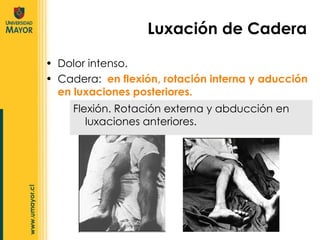 Dolor intenso. Cadera:  en flexión, rotación interna y aducción en luxaciones posteriores. Luxación de Cadera Flexión. Rotación externa y abducción en luxaciones anteriores. 