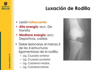 Lesión  infrecuente. Alta energía : acc. De transito Mediana energía : acc. Deportivos, caídas Luxación de Rodilla Debe lesionarse al menos 3 de las 4 estructuras ligamentosas de la rodilla. Lig. Cruzado anterior Lig. Cruzado posterior Lig. Colateral medial. Lig. Colateral lateral. 