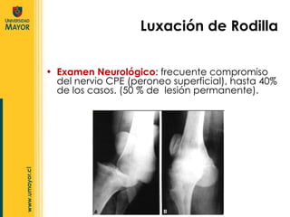 Examen Neurológico : frecuente compromiso del nervio CPE (peroneo superficial), hasta 40% de los casos. (50 % de  lesión permanente). Luxación de Rodilla 