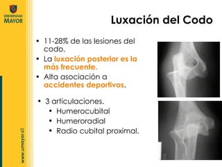 11-28% de las lesiones del codo. La  luxación posterior es la más frecuente. Alta asociación a  accidentes deportivos . Luxación del Codo 3 articulaciones. Humerocubital Humeroradial Radio cubital proximal. 