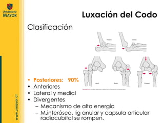 Clasificación Posteriores:  90%  Anteriores Lateral y medial  Divergentes Mecanismo de alta energía M.interósea, lig anular y capsula articular radiocubital se rompen. Luxación del Codo 