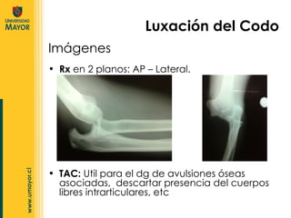 Imágenes Luxación del Codo Rx  en 2 planos: AP – Lateral. TAC:  Util para el dg de avulsiones óseas asociadas,  descartar presencia del cuerpos libres intrarticulares, etc  