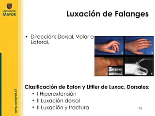 Dirección: Dorsal, Volar o Lateral. Luxación de Falanges Clasificación de Eaton y Littler de Luxac. Dorsales: I Hiperextensión II Luxación dorsal II Luxación y fractura 