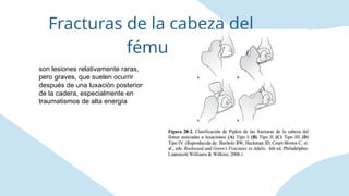 Lesiones Raras Presentación de Luxaciones y fracturas.pptx