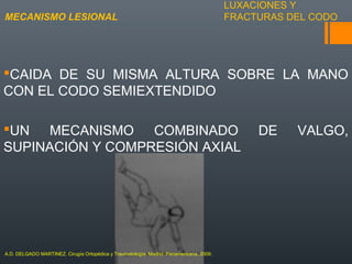 LUXACIONES Y
FRACTURAS DEL CODO
CAIDA DE SU MISMA ALTURA SOBRE LA MANO
CON EL CODO SEMIEXTENDIDO
UN MECANISMO COMBINADO DE VALGO,
SUPINACIÓN Y COMPRESIÓN AXIAL
MECANISMO LESIONAL
A.D. DELGADO MARTINEZ. Cirugía Ortopédica y Traumatología. Madrid: Panamericana, 2009.
 