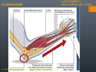 LUXACIONES Y
FRACTURAS DEL CODOCLASIFICACIÓN
A.D. DELGADO MARTINEZ. Cirugía Ortopédica y Traumatología. Madrid: Panamericana, 2009.
 