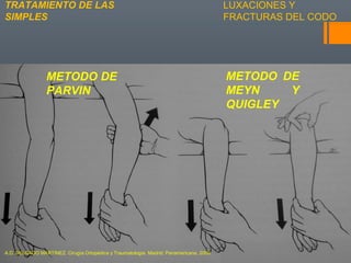 LUXACIONES Y
FRACTURAS DEL CODO
TRATAMIENTO DE LAS
SIMPLES
METODO DE
PARVIN
METODO DE
MEYN Y
QUIGLEY
A.D. DELGADO MARTINEZ. Cirugía Ortopédica y Traumatología. Madrid: Panamericana, 2009.
 