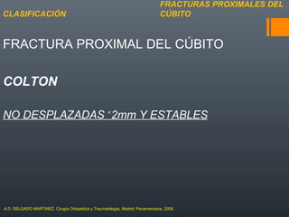 FRACTURA PROXIMAL DEL CÚBITO
COLTON
NO DESPLAZADAS 2mm Y ESTABLES˂
FRACTURAS PROXIMALES DEL
CÚBITOCLASIFICACIÓN
A.D. DELGADO MARTINEZ. Cirugía Ortopédica y Traumatología. Madrid: Panamericana, 2009.
 