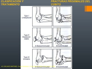 FRACTURAS PROXIMALES DEL
CÚBITO
CLASIFICACIÓN Y
TRATAMIENTO
A.D. DELGADO MARTINEZ. Cirugía Ortopédica y Traumatología. Madrid: Panamericana, 2009.
 