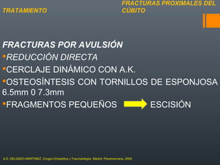 FRACTURAS POR AVULSIÓN
REDUCCIÓN DIRECTA
CERCLAJE DINÁMICO CON A.K.
OSTEOSÍNTESIS CON TORNILLOS DE ESPONJOSA
6.5mm 0 7.3mm
FRAGMENTOS PEQUEÑOS ESCISIÓN
FRACTURAS PROXIMALES DEL
CÚBITOTRATAMIENTO
A.D. DELGADO MARTINEZ. Cirugía Ortopédica y Traumatología. Madrid: Panamericana, 2009.
 