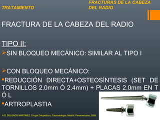 FRACTURA DE LA CABEZA DEL RADIO
TIPO II:
SIN BLOQUEO MECÁNICO: SIMILAR AL TIPO I
CON BLOQUEO MECÁNICO:
REDUCCIÓN DIRECTA+OSTEOSÍNTESIS (SET DE
TORNILLOS 2.0mm Ó 2.4mm) + PLACAS 2.0mm EN T
Ó L
ARTROPLASTIA
FRACTURAS DE LA CABEZA
DEL RADIOTRATAMIENTO
A.D. DELGADO MARTINEZ. Cirugía Ortopédica y Traumatología. Madrid: Panamericana, 2009.
 