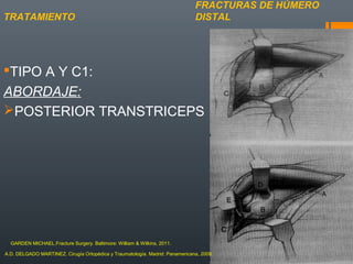 TIPO A Y C1:
ABORDAJE:
POSTERIOR TRANSTRICEPS
FRACTURAS DE HÚMERO
DISTALTRATAMIENTO
A.D. DELGADO MARTINEZ. Cirugía Ortopédica y Traumatología. Madrid: Panamericana, 2009.
GARDEN MICHAEL.Fracture Surgery. Baltimore: William & Wilkins, 2011.
 
