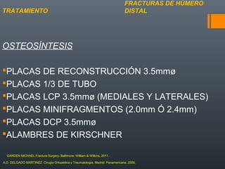 OSTEOSÍNTESIS
PLACAS DE RECONSTRUCCIÓN 3.5mmø
PLACAS 1/3 DE TUBO
PLACAS LCP 3.5mmø (MEDIALES Y LATERALES)
PLACAS MINIFRAGMENTOS (2.0mm Ó 2.4mm)
PLACAS DCP 3.5mmø
ALAMBRES DE KIRSCHNER
FRACTURAS DE HÚMERO
DISTALTRATAMIENTO
A.D. DELGADO MARTINEZ. Cirugía Ortopédica y Traumatología. Madrid: Panamericana, 2009.
GARDEN MICHAEL.Fracture Surgery. Baltimore: William & Wilkins, 2011.
 