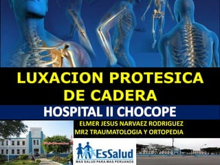 HOSPITAL II CHOCOPE
LUXACION PROTESICA
DE CADERA
ELMER JESUS NARVAEZ RODRIGUEZ
MR2 TRAUMATOLOGIA Y ORTOPEDIA
 