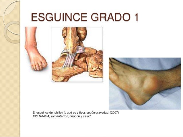 hipertensión arterial síntomas hoja cheet