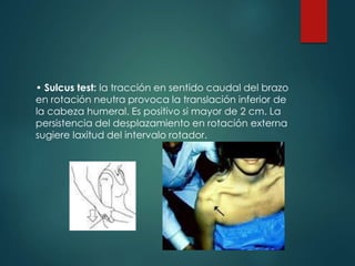 • Sulcus test: la tracción en sentido caudal del brazo
en rotación neutra provoca la translación inferior de
la cabeza humeral. Es positivo si mayor de 2 cm. La
persistencia del desplazamiento en rotación externa
sugiere laxitud del intervalo rotador.
 