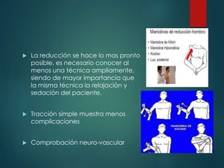  La reducción se hace lo mas pronto
posible, es necesario conocer al
menos una técnica ampliamente,
siendo de mayor importancia que
la misma técnica la relajación y
sedación del paciente.
 Tracción simple muestra menos
complicaciones
 Comprobación neuro-vascular
 