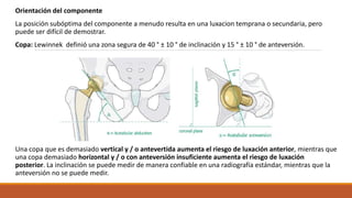 Luxaxcion recurrente de protesis total de cadera | PPT