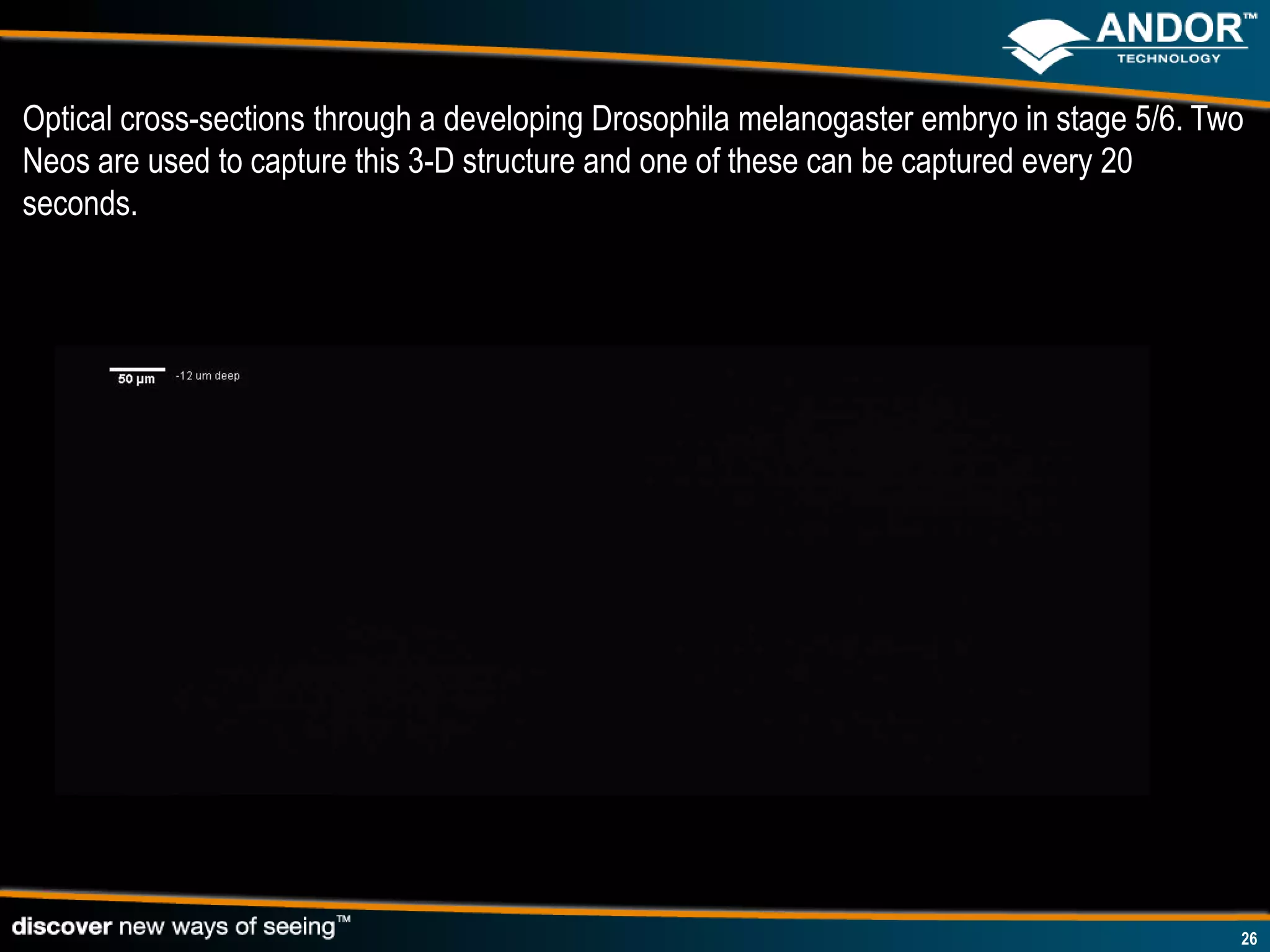 Optical cross-sections through a developing Drosophila melanogaster embryo in stage 5/6. Two
Neos are used to capture this 3-D structure and one of these can be captured every 20
seconds.




                                                                                           26
 
