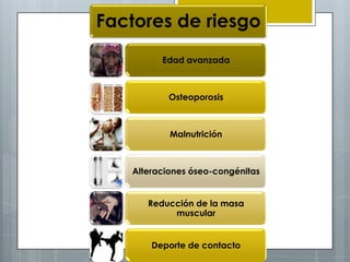 Factores de riesgo
         Edad avanzada



           Osteoporosis



           Malnutrición



   Alteraciones óseo-congénitas


      Reducción de la masa
           muscular


       Deporte de contacto
 