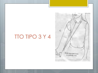 TTO TIPO 3 Y 4
 