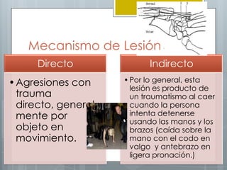 Mecanismo de Lesión
     Directo              Indirecto
•Agresiones con     • Por lo general, esta
                      lesión es producto de
 trauma               un traumatismo al caer
 directo, general     cuando la persona
 mente por            intenta detenerse
                      usando las manos y los
 objeto en            brazos (caída sobre la
 movimiento.          mano con el codo en
                      valgo y antebrazo en
                      ligera pronación.)
 