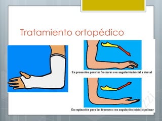 Tratamiento ortopédico
 