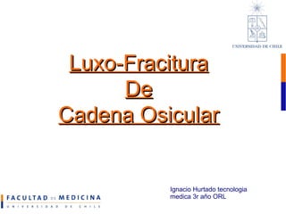 Luxo-Fracitura De Cadena Osicular Ignacio Hurtado tecnologia  medica 3r año ORL 