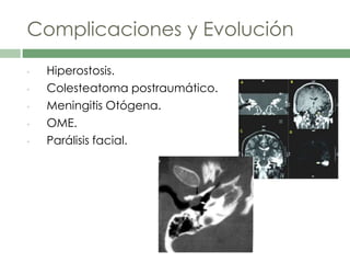 Complicaciones y Evolución
• Hiperostosis.
• Colesteatoma postraumático.
• Meningitis Otógena.
• OME.
• Parálisis facial.
 