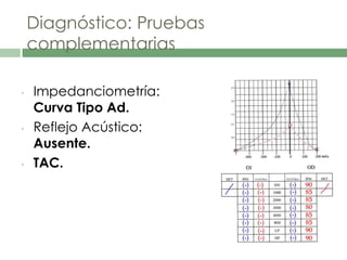 Diagnóstico: Pruebas
complementarias
• Impedanciometría:
Curva Tipo Ad.
• Reflejo Acústico:
Ausente.
• TAC.
 