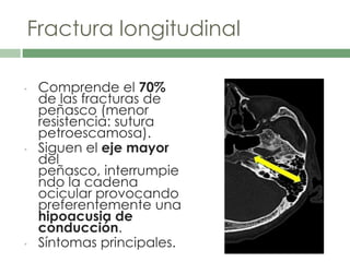 Fractura longitudinal
• Comprende el 70%
de las fracturas de
peñasco (menor
resistencia: sutura
petroescamosa).
• Siguen el eje mayor
del
peñasco, interrumpie
ndo la cadena
ocicular provocando
preferentemente una
hipoacusia de
conducción.
• Síntomas principales.
 