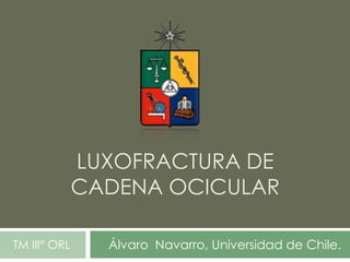 LUXOFRACTURA DE
CADENA OCICULAR
Álvaro Navarro, Universidad de Chile.TM III° ORL
 