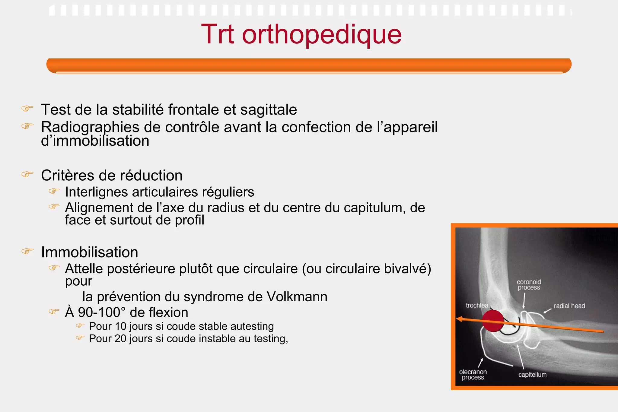 Trt orthopedique Test de la stabilité frontale et sagittale  Radiographies de contrôle avant la confection de l’appareil d’immobilisation Critères de réduction  Interlignes articulaires réguliers Alignement de l’axe du radius et du centre du capitulum, de face et surtout de profil Immobilisation Attelle postérieure plutôt que circulaire (ou circulaire bivalvé) pour la prévention du syndrome de Volkmann À 90-100° de flexion Pour 10 jours si coude stable autesting Pour 20 jours si coude instable au testing, 