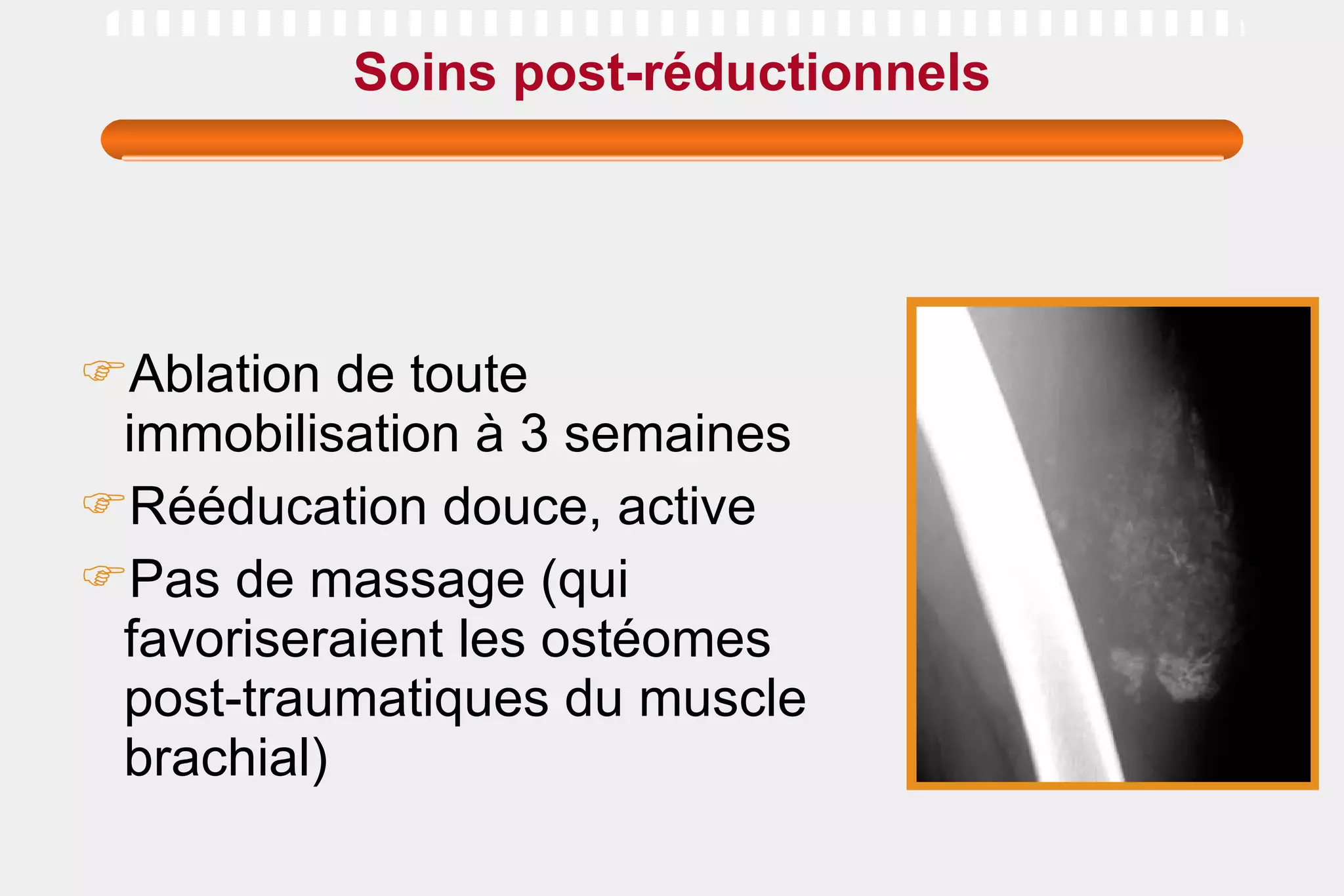 Soins post-réductionnels Ablation de toute immobilisation à 3 semaines Rééducation douce, active  Pas de massage (qui favoriseraient les ostéomes post-traumatiques du muscle brachial) 