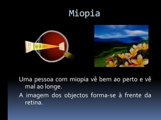 Miopia




Uma pessoa com miopia vê bem ao perto e vê
  mal ao longe.
A imagem dos objectos forma-se à frente da
  retina.
 