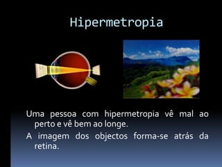 Hipermetropia




Uma pessoa com hipermetropia vê mal ao
 perto e vê bem ao longe.
A imagem dos objectos forma-se atrás da
 retina.
 