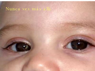 Nunca ves más allá