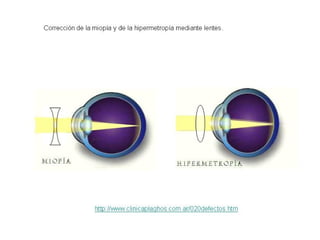 Luz1