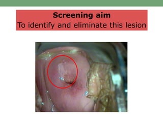 Screening aim
To identify and eliminate this lesion
 