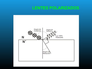 LENTES POLARIZADOS
 