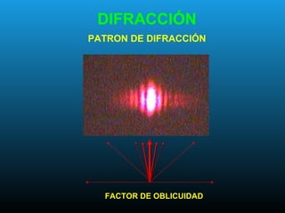DIFRACCIÓN
PATRON DE DIFRACCIÓN
FACTOR DE OBLICUIDAD
 