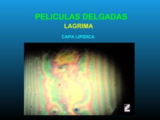 PELICULAS DELGADAS
CAPA LIPIDICA
LAGRIMA
 