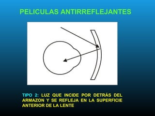 PELICULAS ANTIRREFLEJANTES
TIPO 2: LUZ QUE INCIDE POR DETRÁS DEL
ARMAZON Y SE REFLEJA EN LA SUPERFICIE
ANTERIOR DE LA LENTE
 