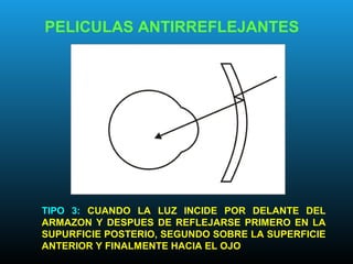PELICULAS ANTIRREFLEJANTES
TIPO 3: CUANDO LA LUZ INCIDE POR DELANTE DEL
ARMAZON Y DESPUES DE REFLEJARSE PRIMERO EN LA
SUPURFICIE POSTERIO, SEGUNDO SOBRE LA SUPERFICIE
ANTERIOR Y FINALMENTE HACIA EL OJO
 