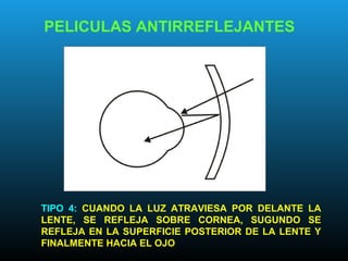 PELICULAS ANTIRREFLEJANTES
TIPO 4: CUANDO LA LUZ ATRAVIESA POR DELANTE LA
LENTE, SE REFLEJA SOBRE CORNEA, SUGUNDO SE
REFLEJA EN LA SUPERFICIE POSTERIOR DE LA LENTE Y
FINALMENTE HACIA EL OJO
 