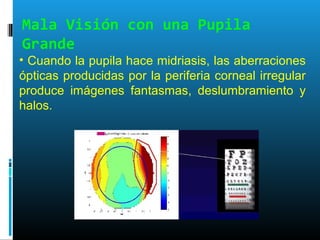 Mala Visión con una Pupila
Grande
• Cuando la pupila hace midriasis, las aberraciones
ópticas producidas por la periferia corneal irregular
produce imágenes fantasmas, deslumbramiento y
halos.
 