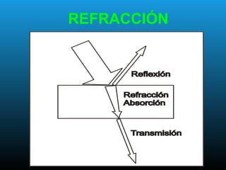REFRACCIÓN
 