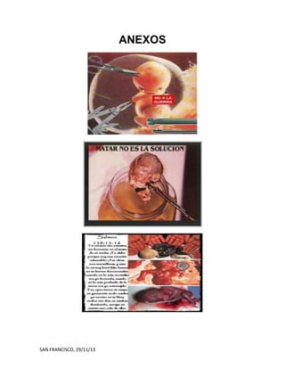 ANEXOS

SAN FRANCISCO, 29/11/13

 