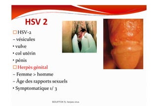 HSV 2
HSV-2
– vésicules
• vulve
• col utérin• col utérin
• pénis
Herpès génital
– Femme > homme
– Âge des rapports sexuels
• Symptomatique 1/ 3
MOUFFOK N, herpes virus
 